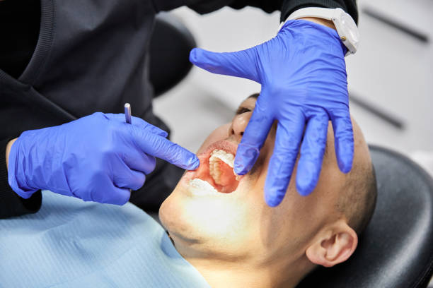 Best Emergency Dental Care for Broken or Chipped Teeth in Crandon Lakes, NJ